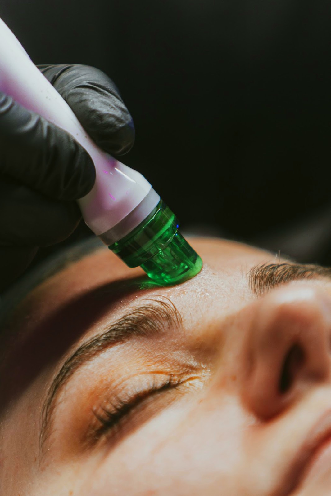 Gros plan d'un appareil d'hydradermabrasion passé sur le visage
